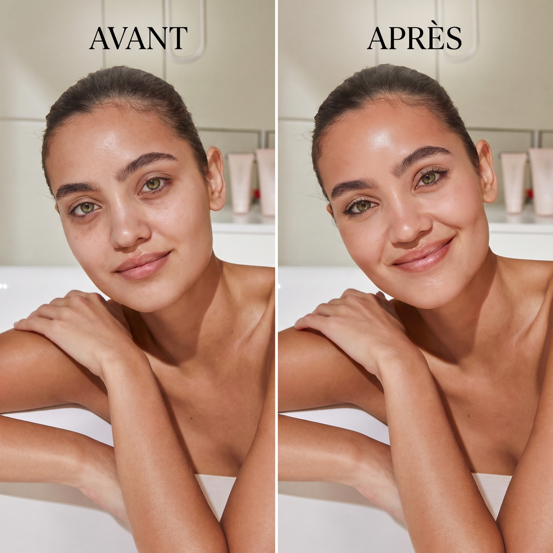 La Brosse Lift KYMA™ — Drainage Lymphatique Visage